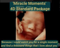 4D scan ultrasound image closeup of baby foetus available from 24 weeks pregnancy onwards